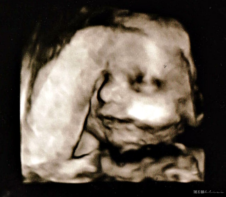 28 Week 3d Ultrasound - Bumpdate - This is our Bliss